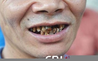 周公解梦梦见掉牙齿(周公解梦梦见掉牙齿掉了)