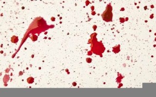 做梦梦到血(做梦梦到血腥的场面是为什么) 做梦梦到血(做梦梦到血腥的场面是为什么)