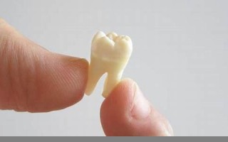 梦见掉牙是什么意思(老年人梦见掉牙是什么意思)